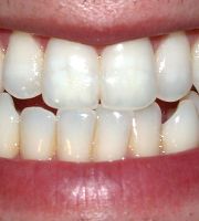teeth